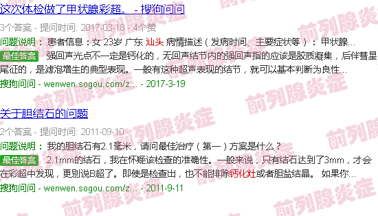 汕头前列腺钙化灶