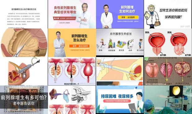 汕头前列腺增生医院排名 - 汕头前列腺增生怎么治疗