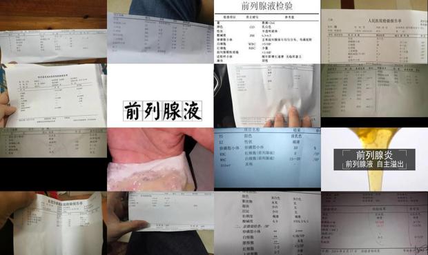 前列腺液多少钱 - 汕头前列腺液