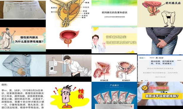 慢性前列腺费用是多少 - 汕头慢性前列腺炎