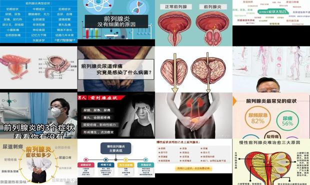 前列腺炎2021 - 汕头前列腺炎有什么症状男