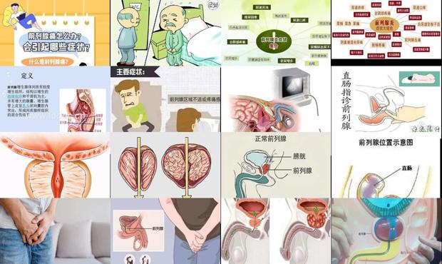 汕头哪里看前列腺炎好 - 汕头前列腺怎么引起来的