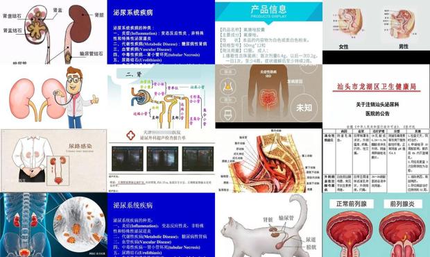 汕头泌尿医院正规吗 - 汕头泌尿系统炎症