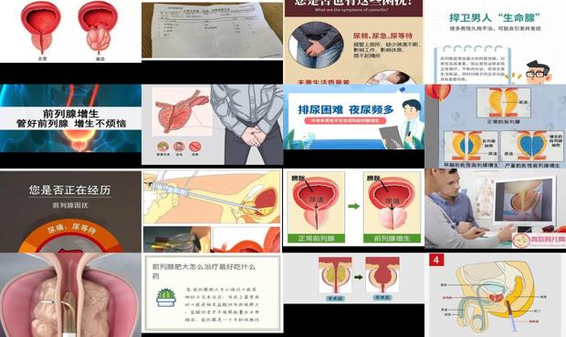 前列腺肥大治疗方案 - 汕头前列腺肥大怎么治疗
