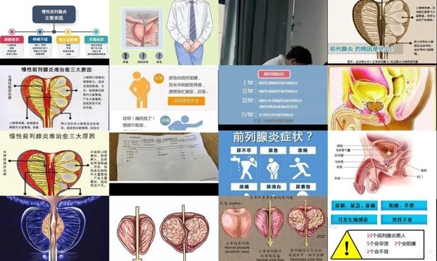 细菌性前列腺怎样治疗最好 - 汕头细菌性前列腺炎症状