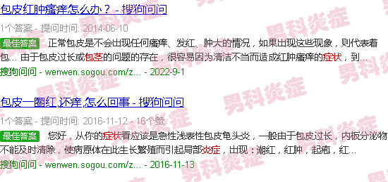 汕头包茎发炎症状图片