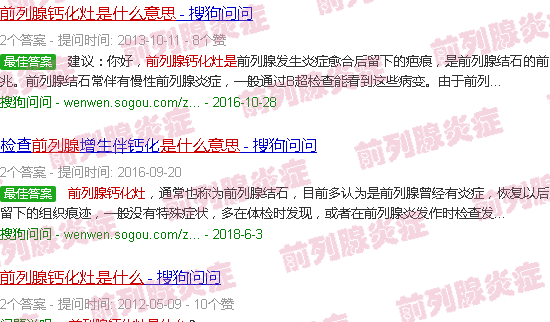 汕头前列腺钙化灶是什么意思