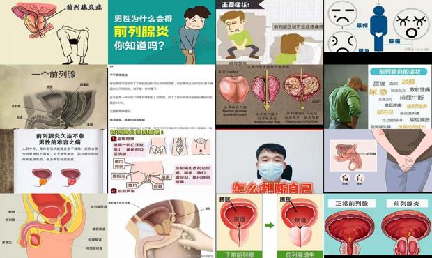 汕头的男人怎么样 - 汕头男生怎么判断自己得了前列腺炎