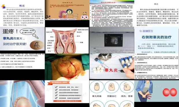 皋丸炎治疗费用 - 汕头皋丸炎症状