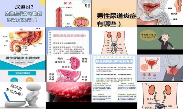 男性尿道炎能不能根治 - 汕头男性尿道炎症状表现图片