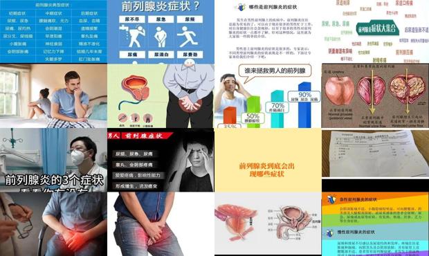 汕头哪里看前列腺炎好 - 汕头前列腺炎症状有哪些症状