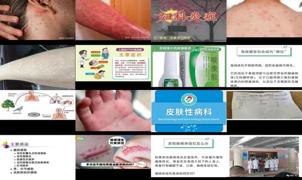 炎症感染怎么治疗 - 汕头炎症感染有什么症状