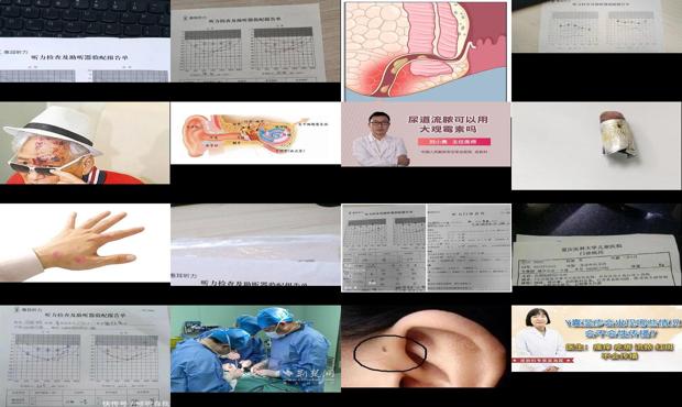 汕头生殖中心哪个医院哪个好 - 汕头男士生殖器有炎症流脓