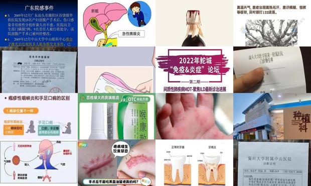 头炎症是什么 - 汕头炎症怎么引起的
