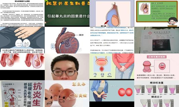 高丸炎用什么药治才好 - 汕头高丸炎症是什么引起的
