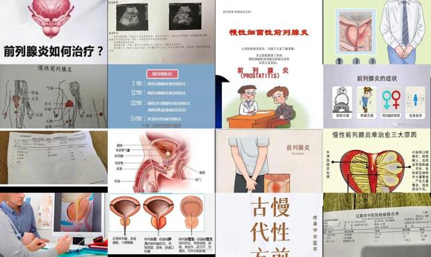 慢性无菌性的炎症 - 汕头慢性无菌性前列腺炎
