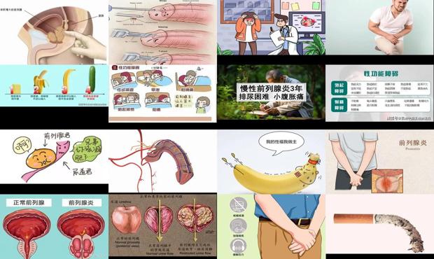 前列腺炎会发作吗 - 汕头前列腺炎会引起性功能勃起障碍吗