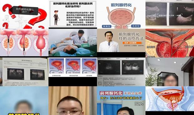 前列腺钙化治的好吗 - 汕头前列腺钙化怎么治疗
