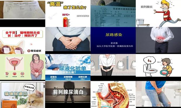 尿炎症怎么治疗方法 - 汕头尿炎症状表现