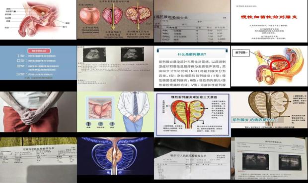 慢性非细菌性前列腺炎什么意思 - 汕头慢性非细菌性前列腺炎