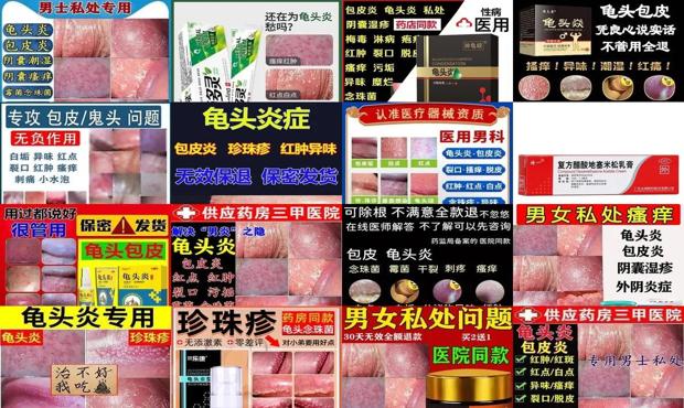 霉菌性龟炎最好的药 - 汕头霉菌性龟头炎症状表现用什么药