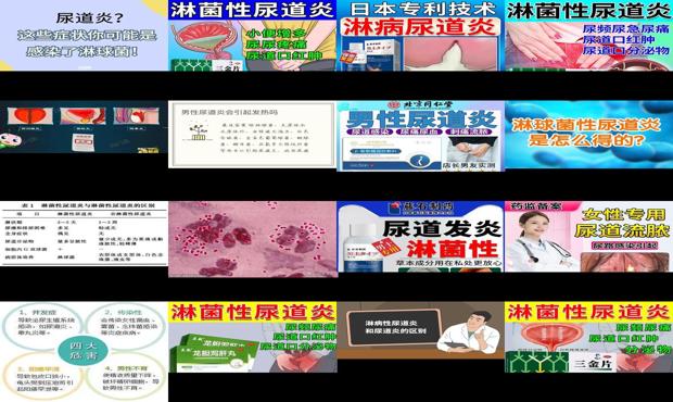 汕头淋球菌性尿道炎医院 - 汕头淋球菌性尿道炎症