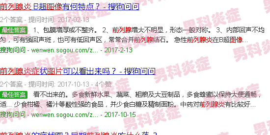 汕头什么是前列腺炎症图片