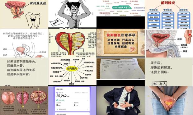 前列腺炎一般怎么治疗的?多少钱? - 汕头前列腺炎如何自愈