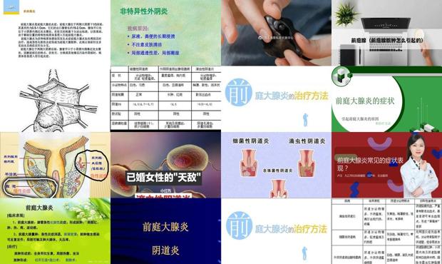 前庭大腺炎治疗费用 - 汕头前庭大腺炎症状