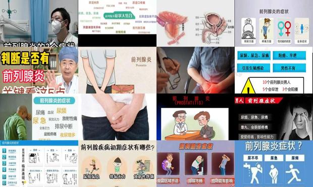 慢性前列炎症状 - 汕头前列炎症状表现