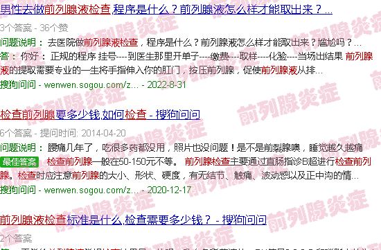 汕头前列腺液检查