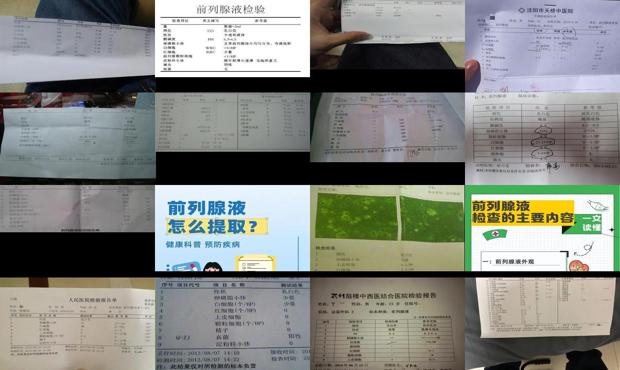 汕头前列腺液检查多少钱 - 汕头前列腺液检查