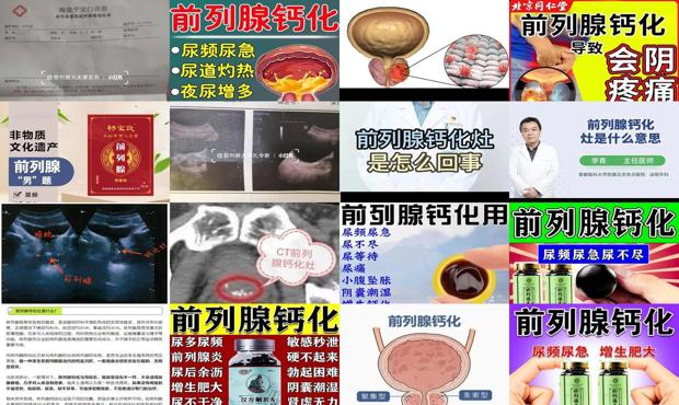 前列腺钙化了怎么治 - 汕头前列腺钙化有什么影响