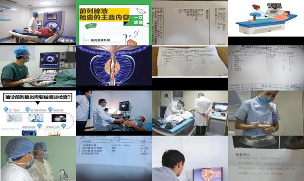 汕头哪里看前列腺炎好 - 汕头前列腺检查