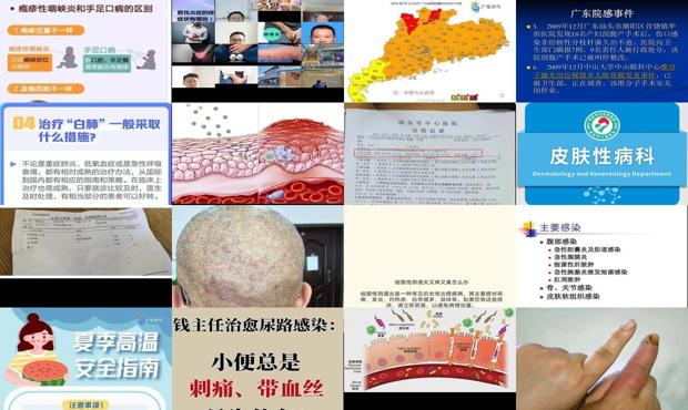 炎症感染会传染吗 - 汕头炎症感染是怎么回事