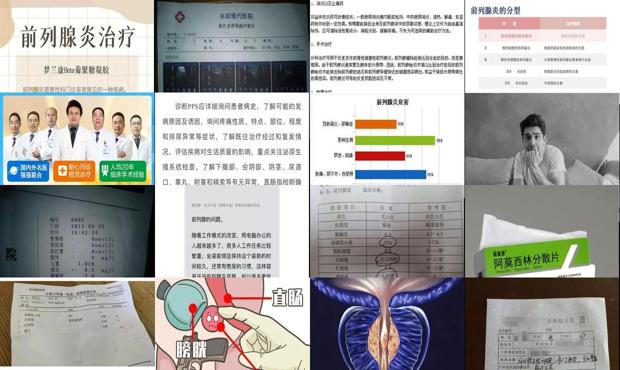 前列腺炎治疗要花多少钱 正规医院 - 汕头前列腺炎治疗费用