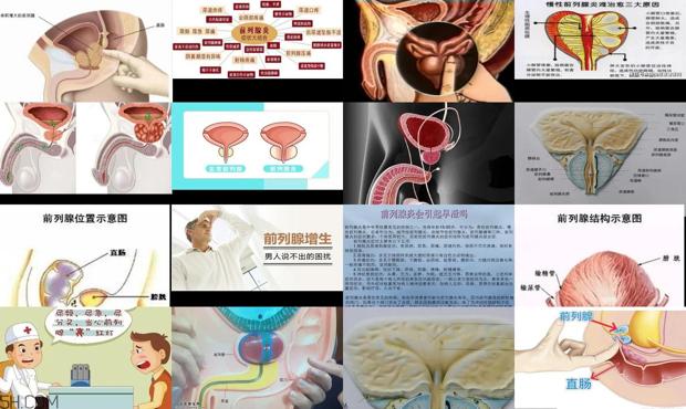 汕头中心医院 前列腺 - 汕头前列腺是怎么引起的