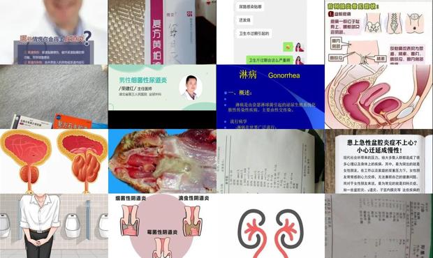 汕头急性尿道炎症