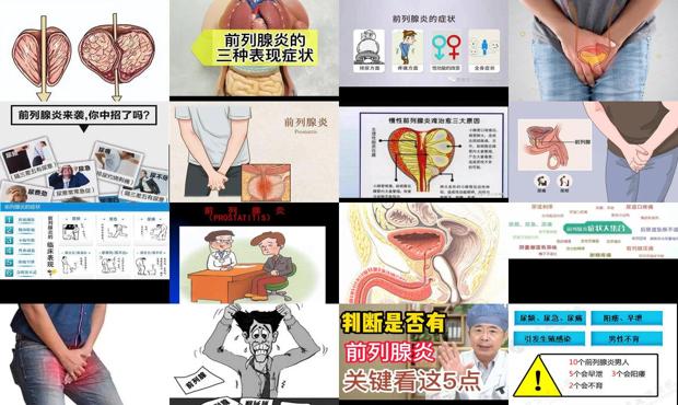 前列腺炎症症状是什么症状 - 汕头前列炎症状