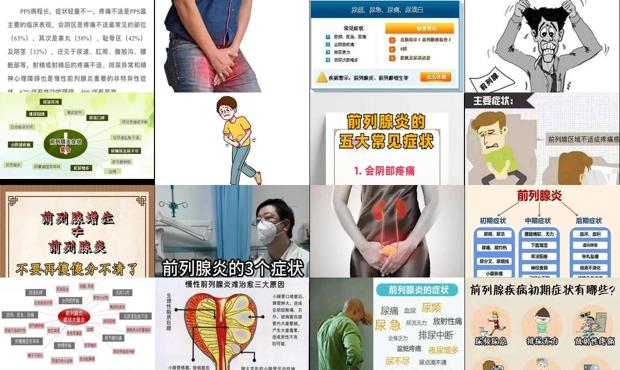 前列腺炎治疗效果怎么样 - 汕头前列腺炎的症状和表现