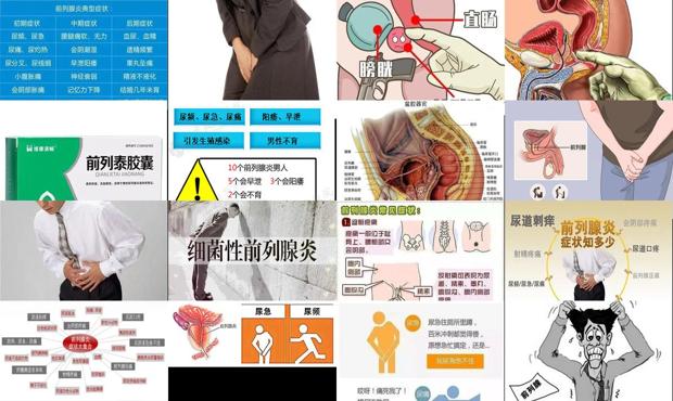 专治慢性前列腺的医院 - 汕头慢性前列腺炎症症状