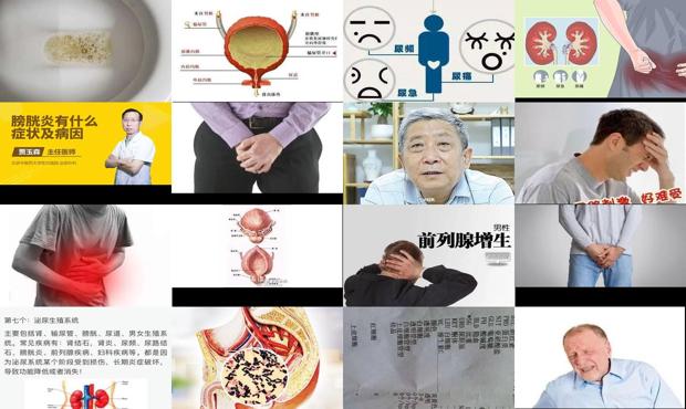 膀胱炎男的早期症状 - 汕头男人膀胱炎症状