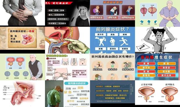 前列腺发炎是什么病 - 汕头前列腺发炎症状