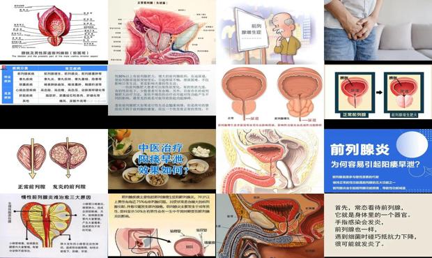 前列腺炎影响怀孕吗? - 汕头前列腺影响性功能吗