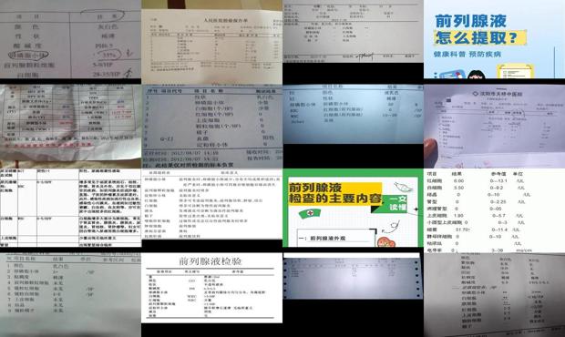 前列腺液检查收费标准 - 汕头前列腺液检查正常标准