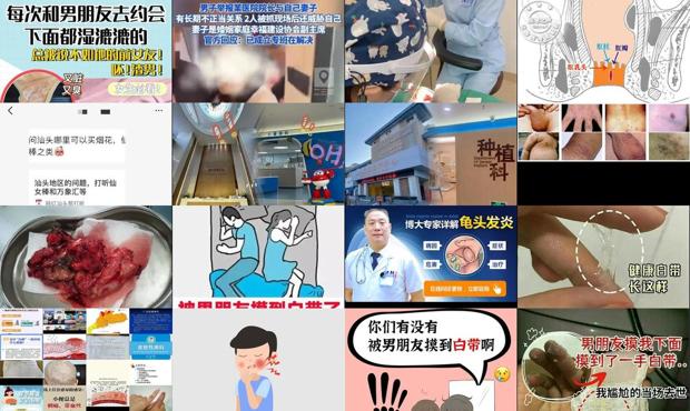 男人下面有阴虱什么原因 - 汕头男的下面有炎症