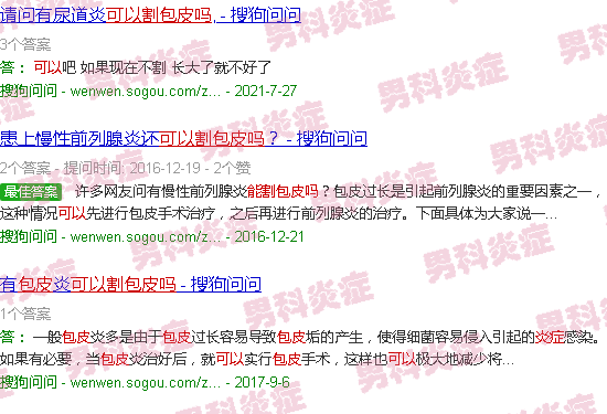汕头有炎症能割包皮吗
