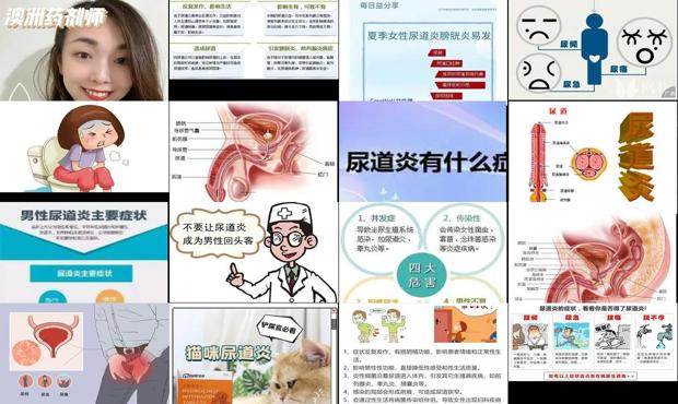你尿道炎 - 汕头尿道炎症状表现如何快速解决