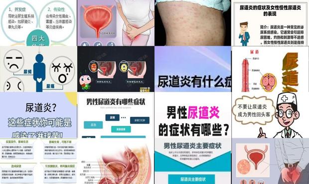 尿道炎后遗症什么症状 - 汕头后尿道炎症状表现