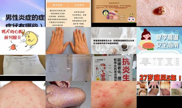男人炎症感染哪些症状 - 汕头男人炎症是什么症状